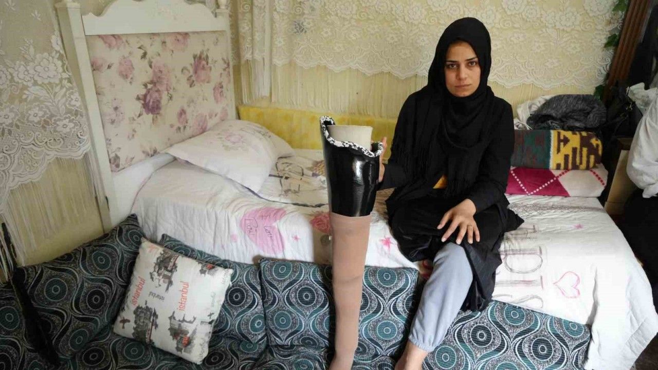 Depremde bacağını kaybetti, eşi terk etti