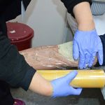 Uşak Eğitim ve Araştırma Hastanesinde Çamur Tedavisi Uygulanıyor