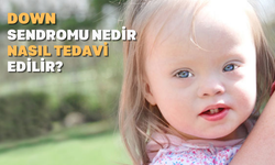 Down Sendromu Nedir? Nasıl Tedavi Edilir?