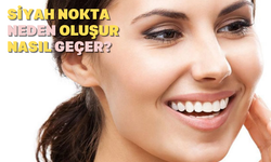 Siyah Nokta Neden Oluşur? Nasıl Geçer?