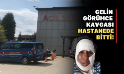 Görümcesinin yüzüne kaynar su döktü!