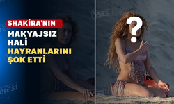 Shakira'nın Doğal Hali Olay Oldu!