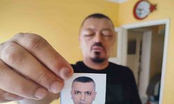 Saçları için aldığı siyahlaştırıcı şampuan saçlarını değil hayatını kararttı