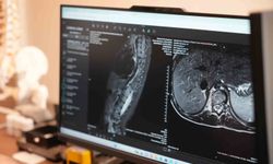 Bu sinsi rahatsızlığı ilk fark eden anneler oluyor