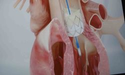 Gençlerde ani ölümlerin sebebi genellikle genetik nedenler