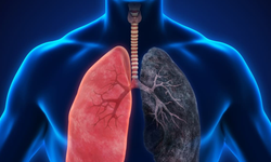 PRP yönteminin KOAH tedavisinde bilimsel bir yeri yok