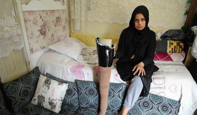 Depremde bacağını kaybetti, eşi terk etti