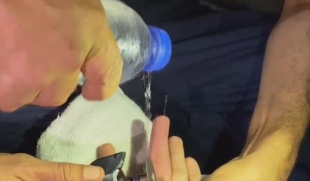 Parmağına yüzük sıkışan vatandaşın imdadına ekipler