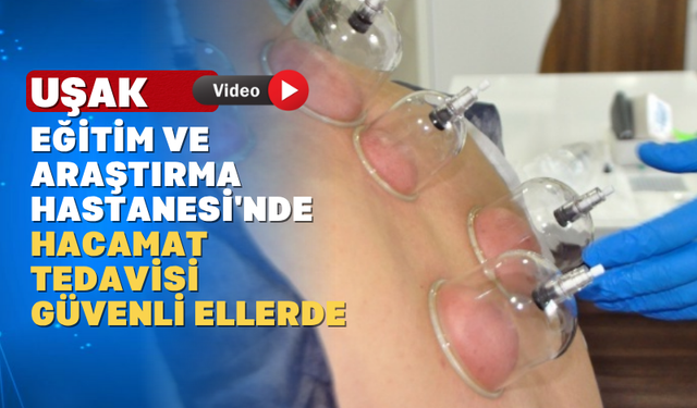 Hacamat Tedavisi Uşak Hastanesinde