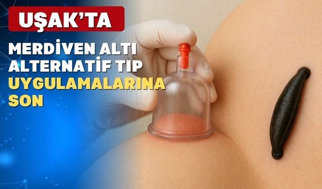 Uşaklılar! Artık Merdiven Altı Hacamat ve Sülük Tedavisi Yaptırmayın