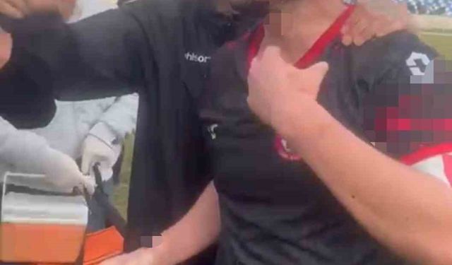 Maç sonu sporcular birbirine girdi: 3 futbolcu yaralandı