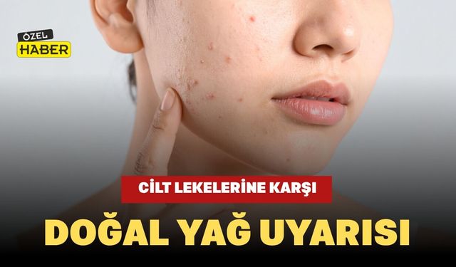 Cilt Lekelerine Karşı Doğal Yağ Uyarısı
