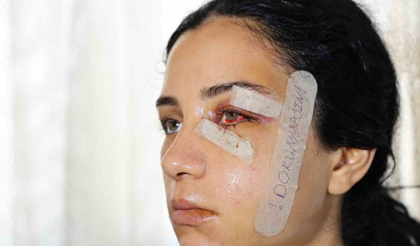 Eski eşini dövüp serbest kalan şüpheli tutuklandı