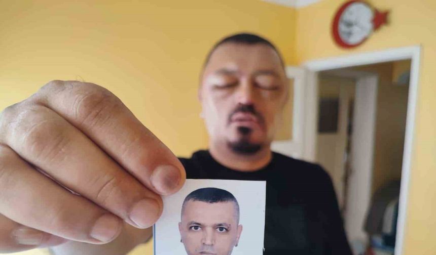 Saçları için aldığı siyahlaştırıcı şampuan saçlarını değil hayatını kararttı