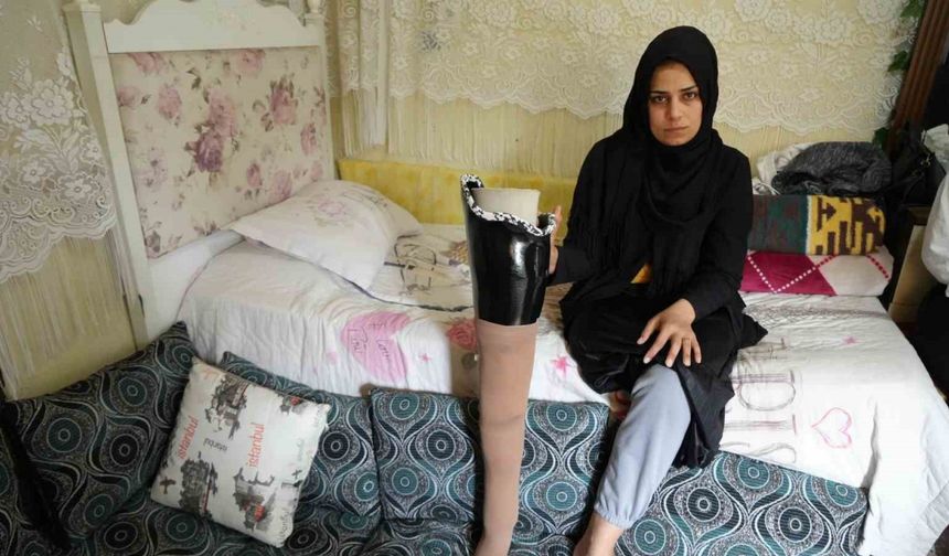 Depremde bacağını kaybetti, eşi terk etti