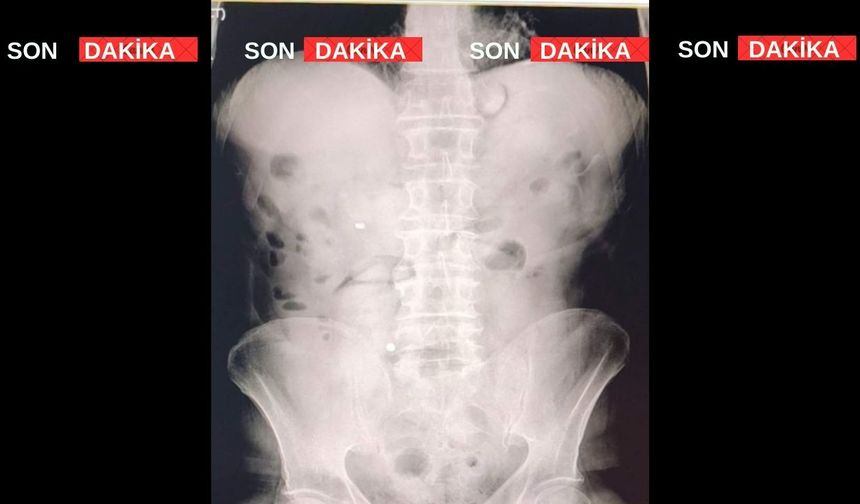 Uşak’ta İranlı 2 kişinin röntgen filmlerinde yasaklı madde çıktı