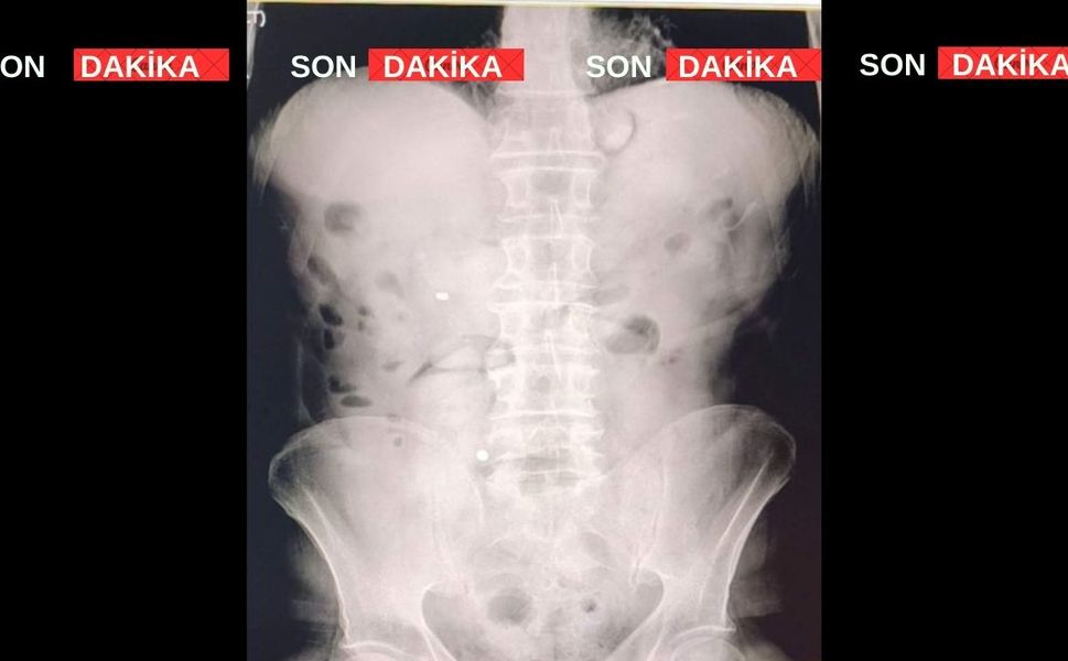 Uşak’ta İranlı 2 kişinin röntgen filmlerinde yasaklı madde çıktı