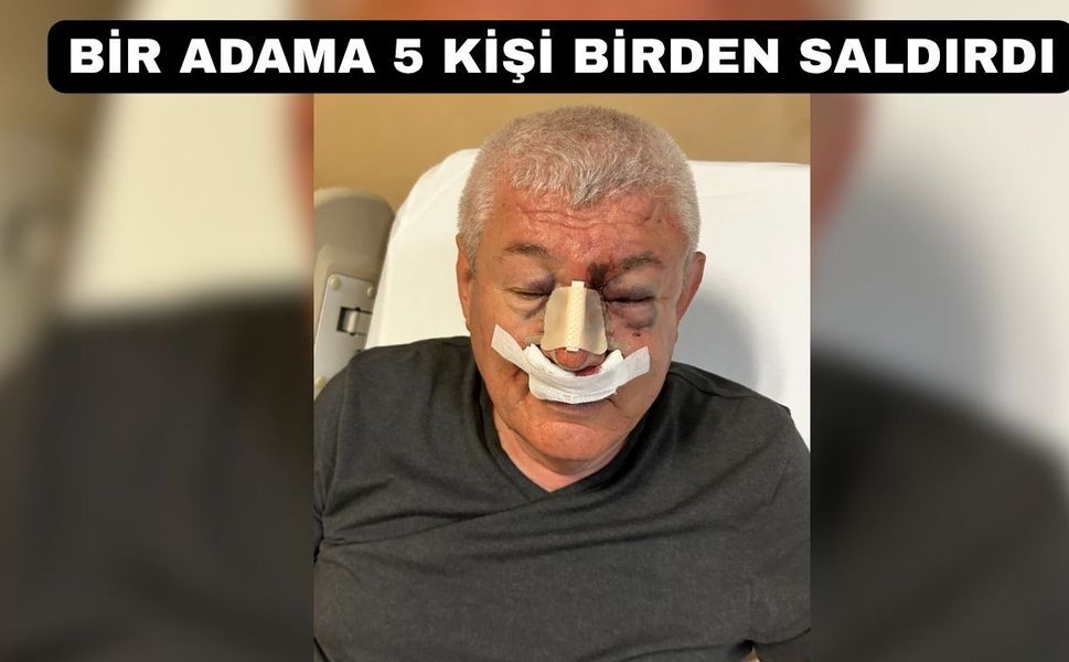 Uşak’ta Çirkin Saldırı; Mahmut Uludağ’ın Burnunu Kırdılar