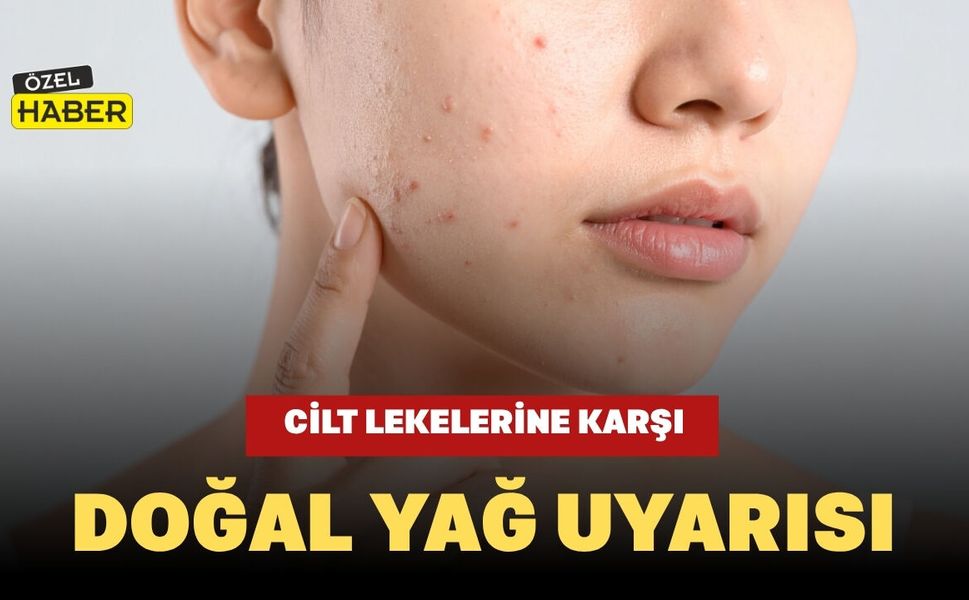 Cilt Lekelerine Karşı Doğal Yağ Uyarısı