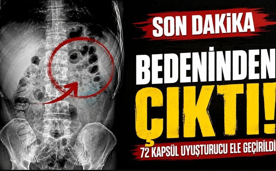Uşak'ta film gibi operasyon: Röntgen gerçeği ortaya çıkardı
