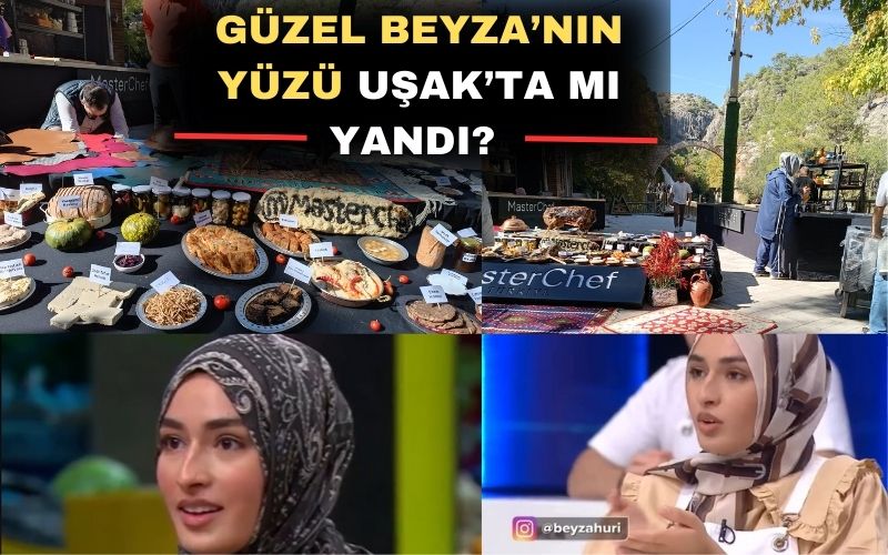 Güzel Beyza’nin Yüzü Uşak’ta Mi Yandi (1)