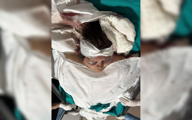 Kaynanasini Dövdü (1)